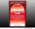 BOOK: Curcumcision Scar - by Jay J. Jackson